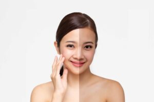 Read more about the article De Tan Face Pack: Breaking the Myth of Natural Remedies vs. Market Products